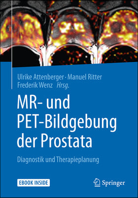 MR- Und Pet-Bildgebung Der Prostata: Diagnostik Und Therapieplanung