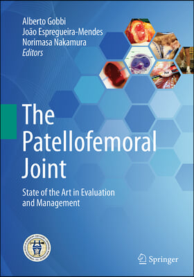 The Patellofemoral Joint: State of the Art in Evaluation and Management