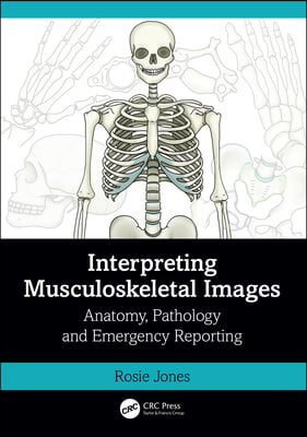 Interpreting Musculoskeletal Images