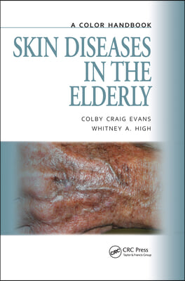 Skin Diseases in the Elderly