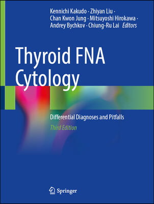 Thyroid Fna Cytology: Differential Diagnoses and Pitfalls