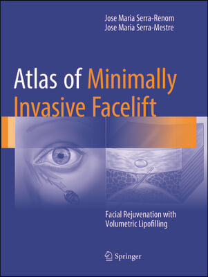 Atlas of Minimally Invasive Facelift