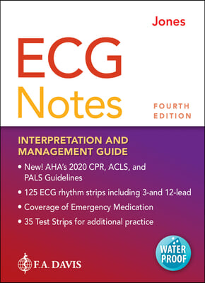 ECG Notes: Interpretation and Management Guide