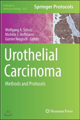 Urothelial Carcinoma: Methods and Protocols