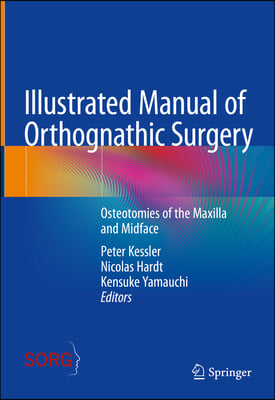 Illustrated Manual of Orthognathic Surgery: Osteotomies of the Maxilla and Midface