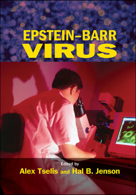 Epstein-Barr Virus