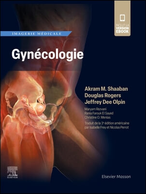 Imagerie M&#233;dicale: Gyn&#233;cologie