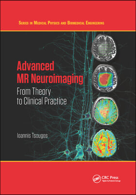 Advanced MR Neuroimaging