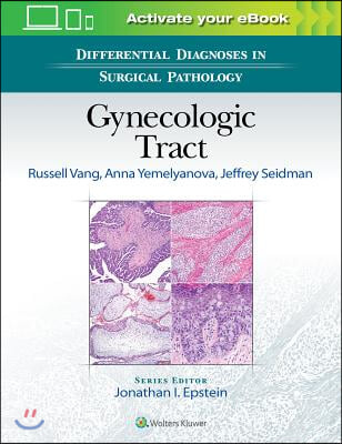 Differential Diagnoses in Surgical Pathology: Gynecologic Tract