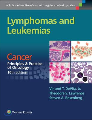 Lymphomas and Leukemias: Cancer: Principles &amp; Practice of Oncology, 10th Edition