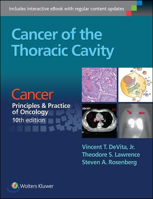 Cancer of the Thoracic Cavity: Cancer: Principles &amp; Practice of Oncology, 10th Edition