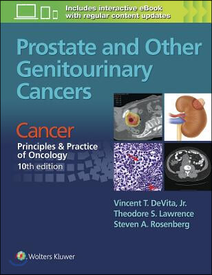 Prostate and Other Genitourinary Cancers: From Cancer: Principles &amp; Practice of Oncology, 10th Edition