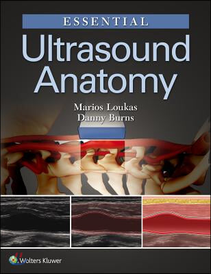 The Essential Ultrasound Anatomy