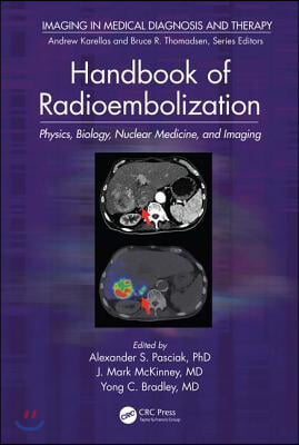 Handbook of Radioembolization