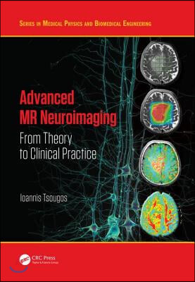 Advanced MR Neuroimaging