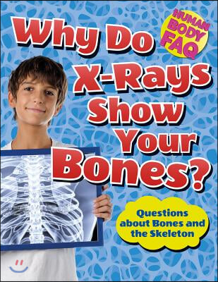 Why Do X-Rays Show Your Bones?: Questions about Bones and the Skeleton