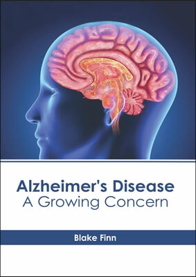 Alzheimer&#39;s Disease: A Growing Concern