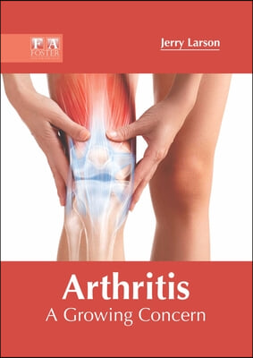 Arthritis: A Growing Concern