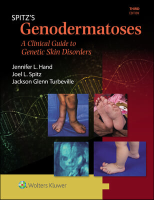 Spitz&#39;s Genodermatoses: A Full Color Clinical Guide to Genetic Skin Disorders