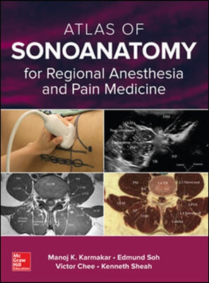 Atlas of Sonoanatomy for Regional Anesthesia and Pain Medicine