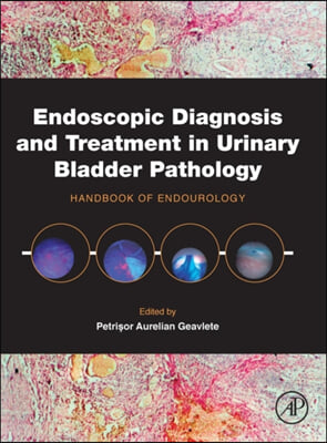 Endoscopic Diagnosis and Treatment in Urinary Bladder Pathology: Handbook of Endourology