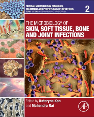 The Microbiology of Skin, Soft Tissue, Bone and Joint Infections: Volume 2