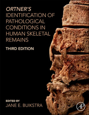 Ortner&#39;s Identification of Pathological Conditions in Human Skeletal Remains