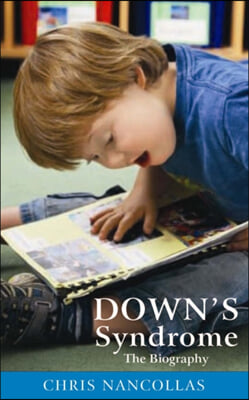 Down&#39;s Syndrome