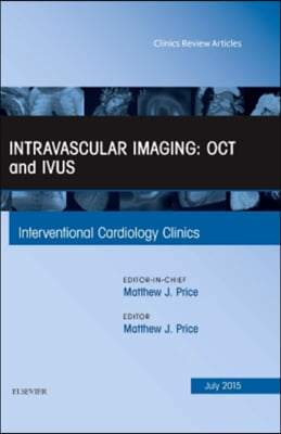 Intravascular Imaging