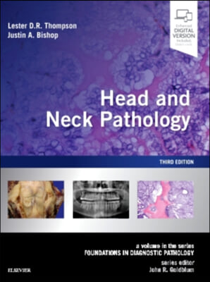 Head and Neck Pathology: A Volume in the Series: Foundations in Diagnostic Pathology