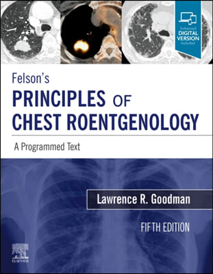Felson&#39;s Principles of Chest Roentgenology, A Programmed Text