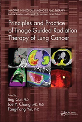 Principles and Practice of Image-Guided Radiation Therapy of Lung Cancer