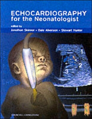 Echocardiography for the Neonatologist