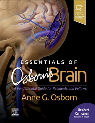 Essentials of Osborn&#39;s Brain: A Fundamental Guide for Residents and Fellows
