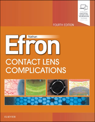 The Contact Lens  Complications