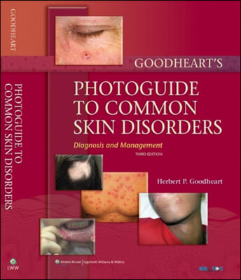 Goodheart&#39;s Photoguide to Common Skin Disorders, 3/E