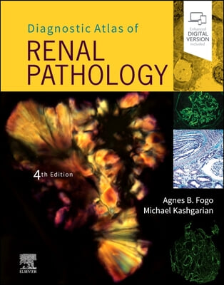 Diagnostic Atlas of Renal Pathology