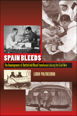 Spain Bleeds: The Development of Battlefield Blood Transfusion During the Civil War