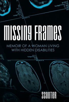 Missing Frames: Memoir of a Woman Living with Hidden Disabilities