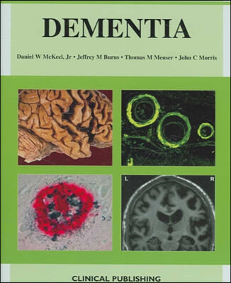 Dementia, an Atlas of Investigation and Diagnosis