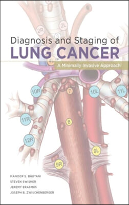 Diagnosis and Staging of Lung Cancer