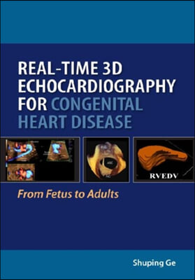 Real-Time 3D Echocardiography for Congenital Heart Disease