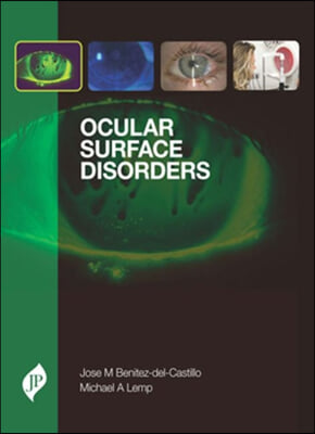 Ocular Surface Disorders