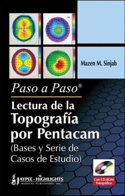 Paso a Paso Lectura De La Topografia Por Pentacam  / Step By Step Reading Pentacam Topography