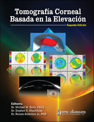 Tomografia Corneal Basada en la Elevacion / Coreal Tomography Based On Elevation