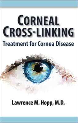 Corneal Cross-Linking: Treatment for Cornea Disease