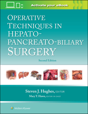 Operative Techniques in Hepato-Pancreato-Biliary Surgery