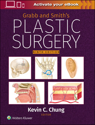 Grabb and Smith&#39;s Plastic Surgery: Print + eBook with Multimedia