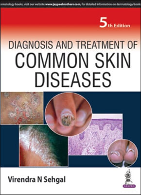 Diagnosis and Treatment of Common Skin Diseases