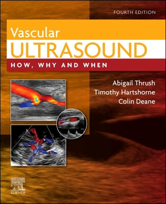 Vascular Ultrasound